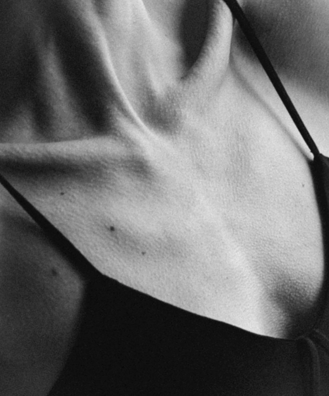 Editorial B&N — cuello y clavícula con tirante, cirugía de mama